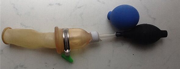 A vacuum extension is used for intensive penile development